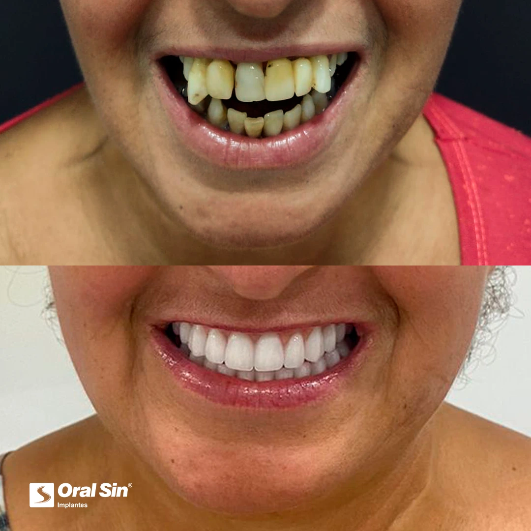 Esteio-antes-e-depois